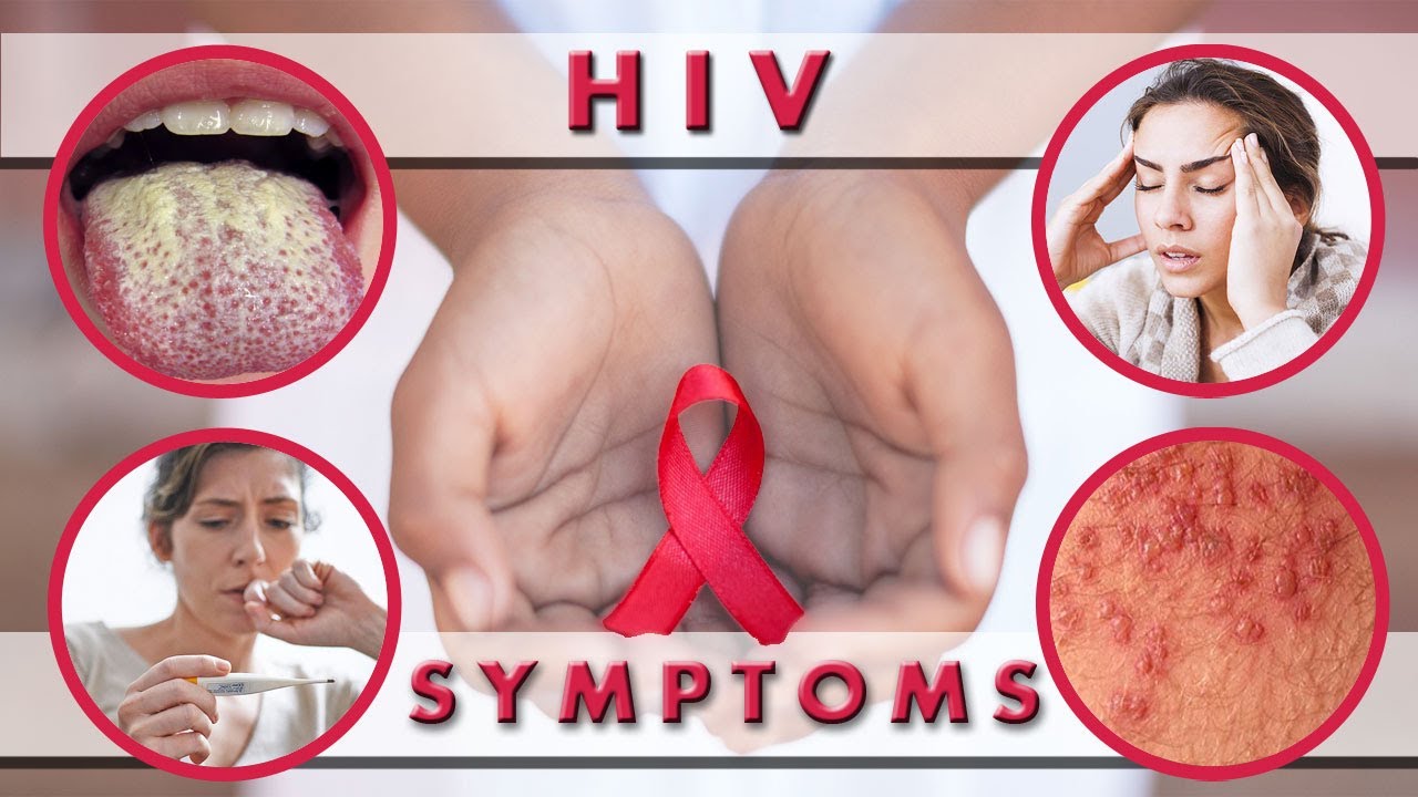 hiv-infection